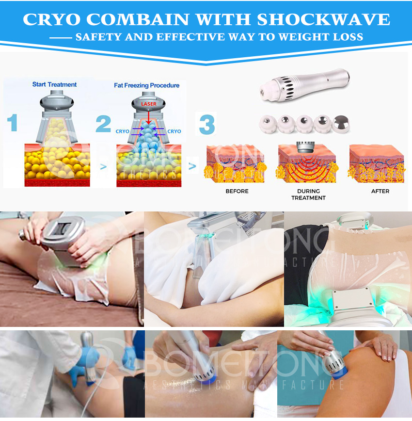 Portable vacuum shockwave machine cellulite treatment electrical Buy vacuum