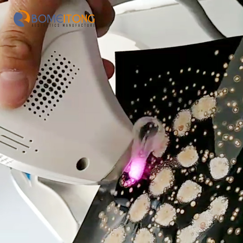 Mini Style 808nm Portable Diode Laser Hair Removal Machine for Home