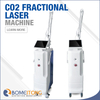 Co2 Fractional Laser Machine Treatment for Wrinkles