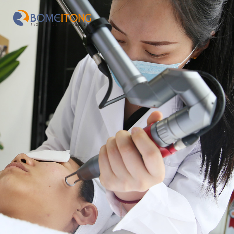 Best Tattoo Removal Laser Equipment Cost for UK Buy best
